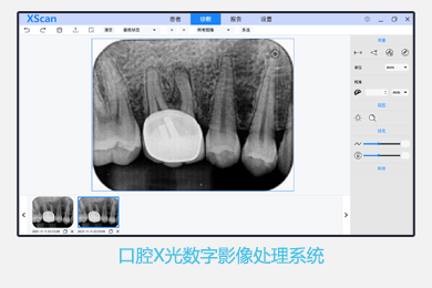 广州慧视科技有限公司-内窥镜影像工作站软件外包定制开发