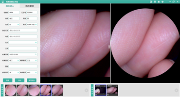 广州慧视科技有限公司-内窥镜影像工作站软件外包定制开发-颅内微创手术内窥镜影像系统