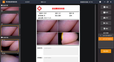 广州慧视科技有限公司-内窥镜影像工作站软件外包定制开发-兽用微创影像系统