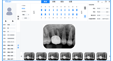 广州慧视科技有限公司-内窥镜影像工作站软件外包定制开发-口腔X光数字影像处理系统